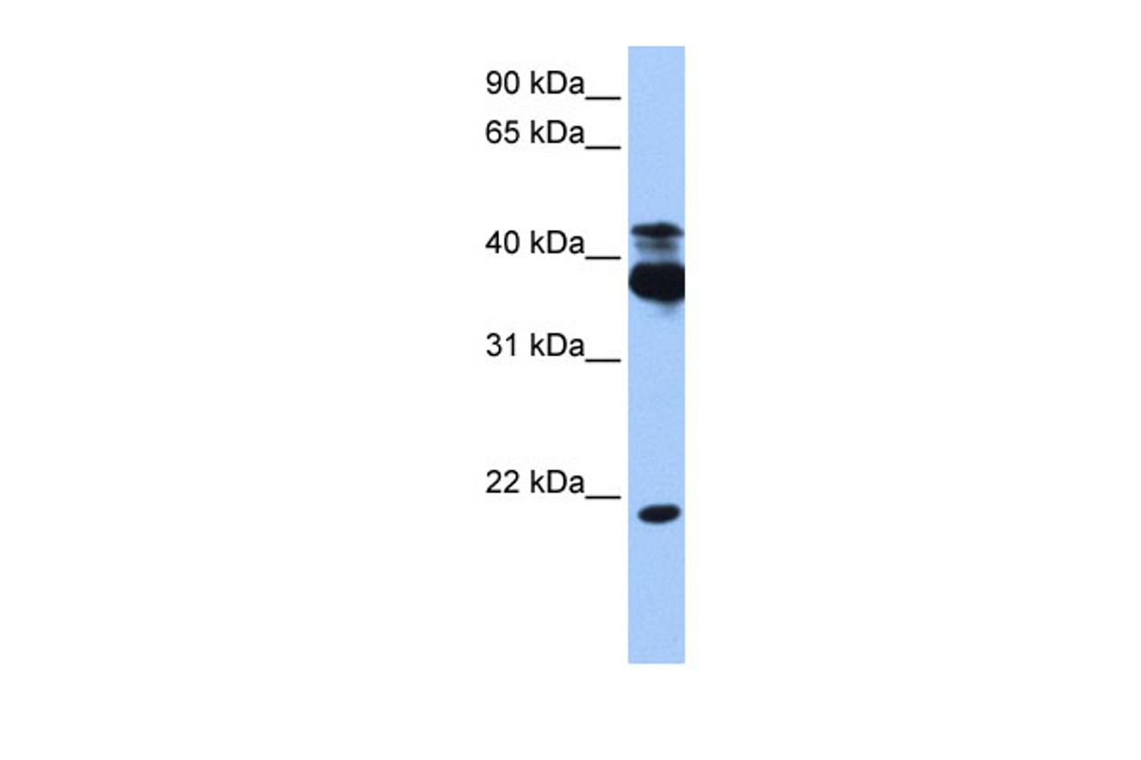Antibody used in WB on Human HepG2 at 0.2-1 ug/ml.