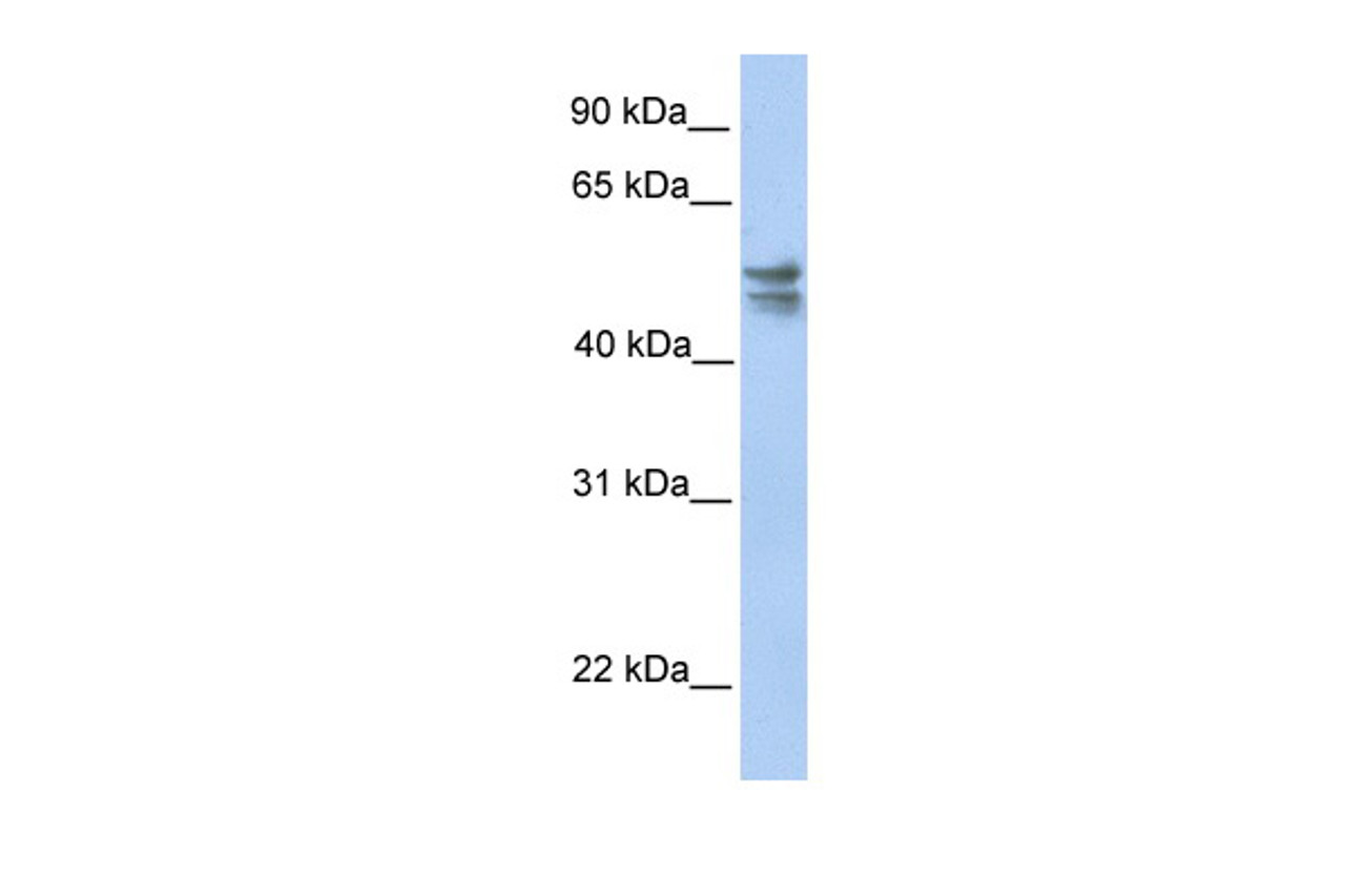 Antibody used in WB on Human HeLa at 0.2-1 ug/ml.