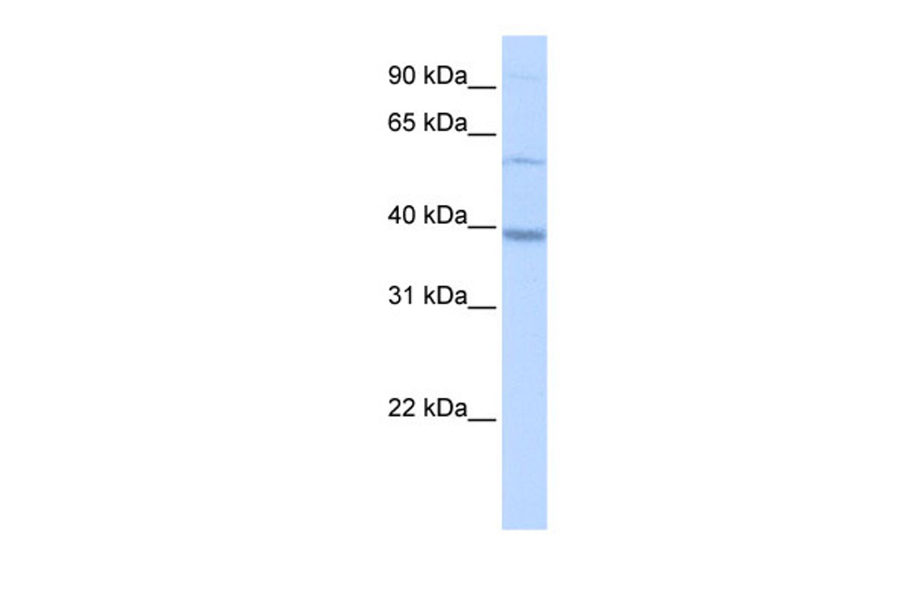 Antibody used in WB on Human HepG2 at 0.2-1 ug/ml.