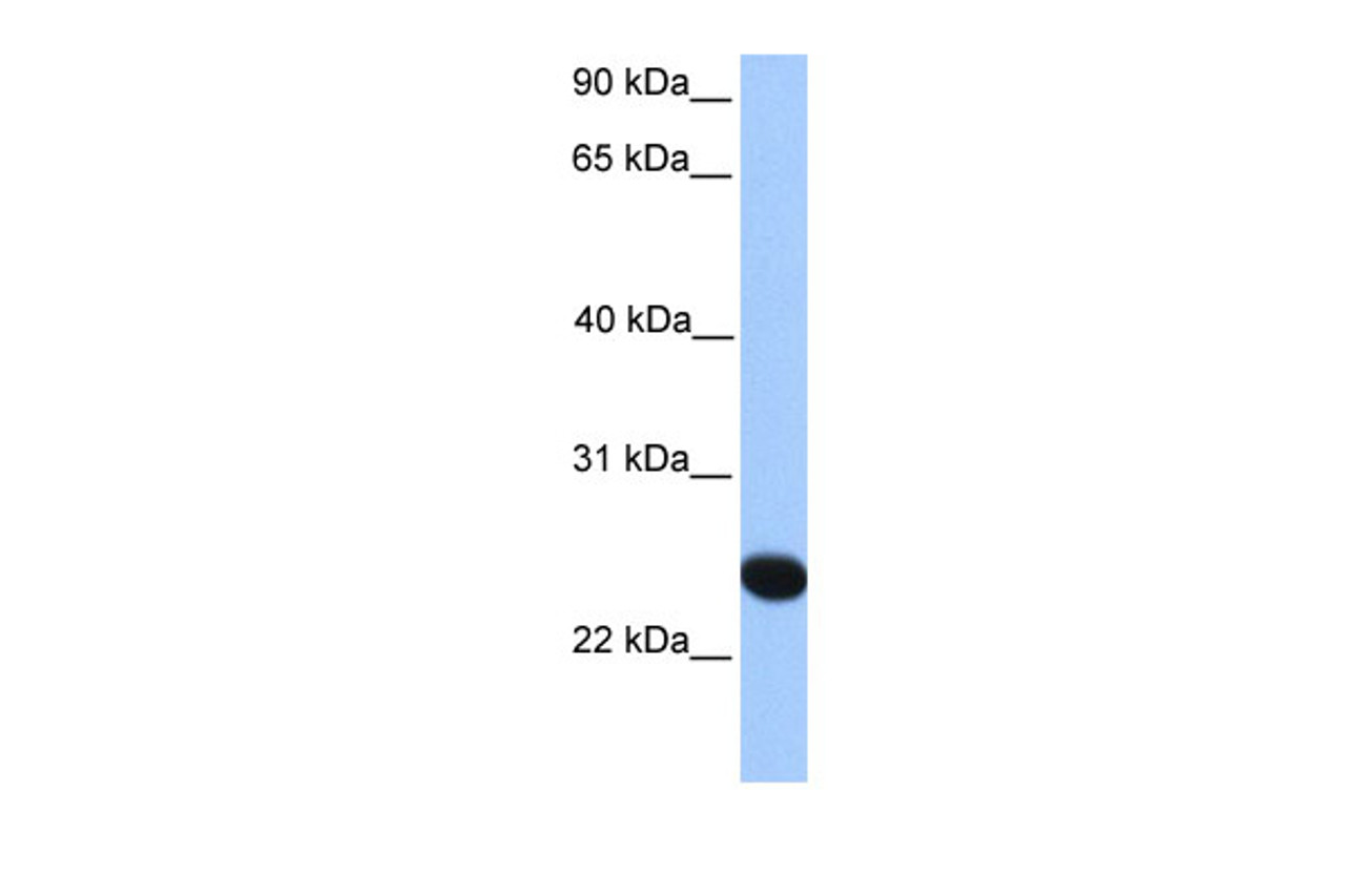 Antibody used in WB on Human Liver at 0.2-1 ug/ml.