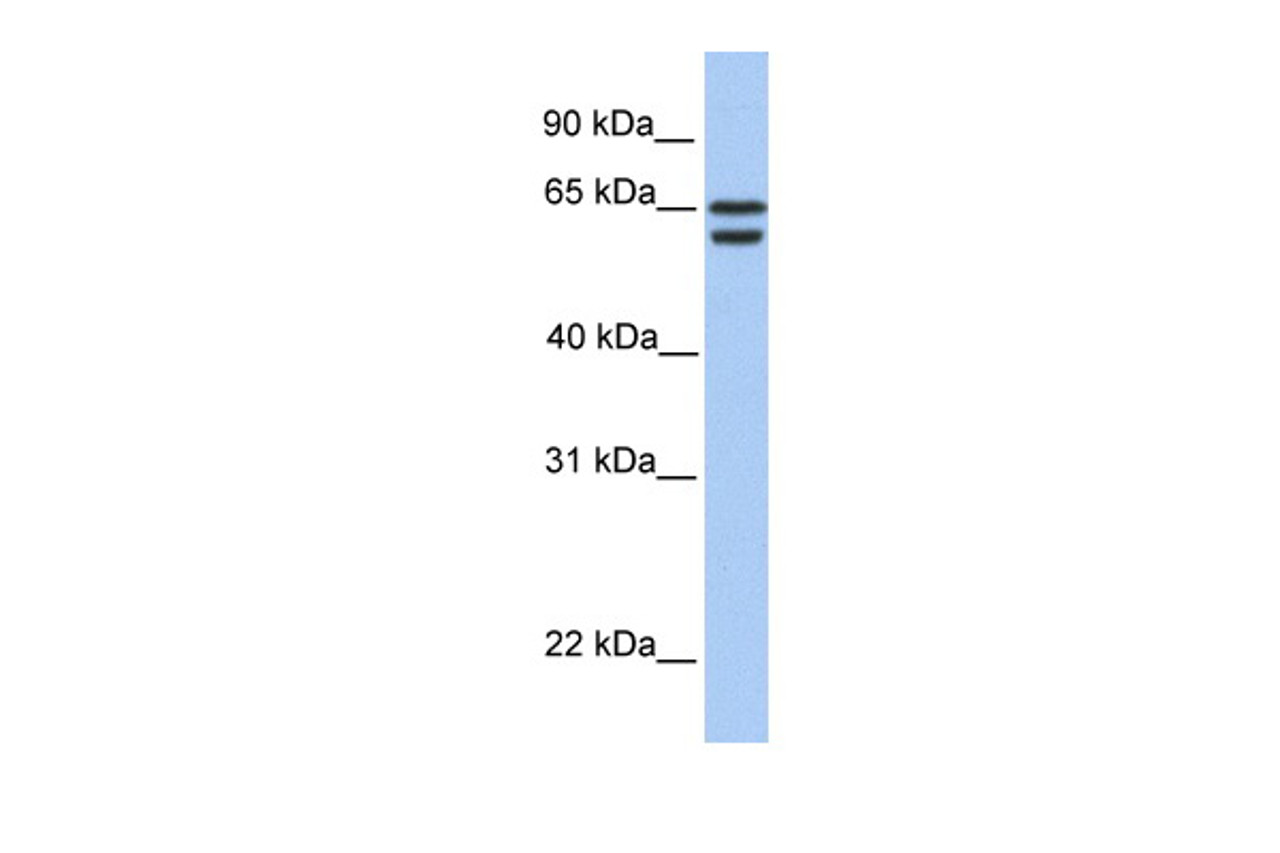 Antibody used in WB on Human 721_B at 0.2-1 ug/ml.