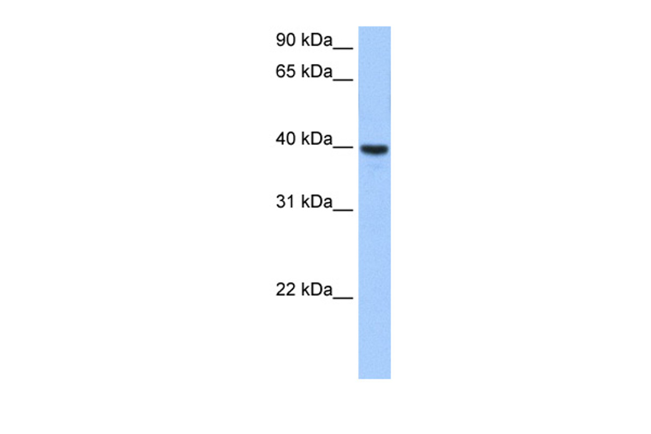 Antibody used in WB on Human Brain at 0.2-1 ug/ml.