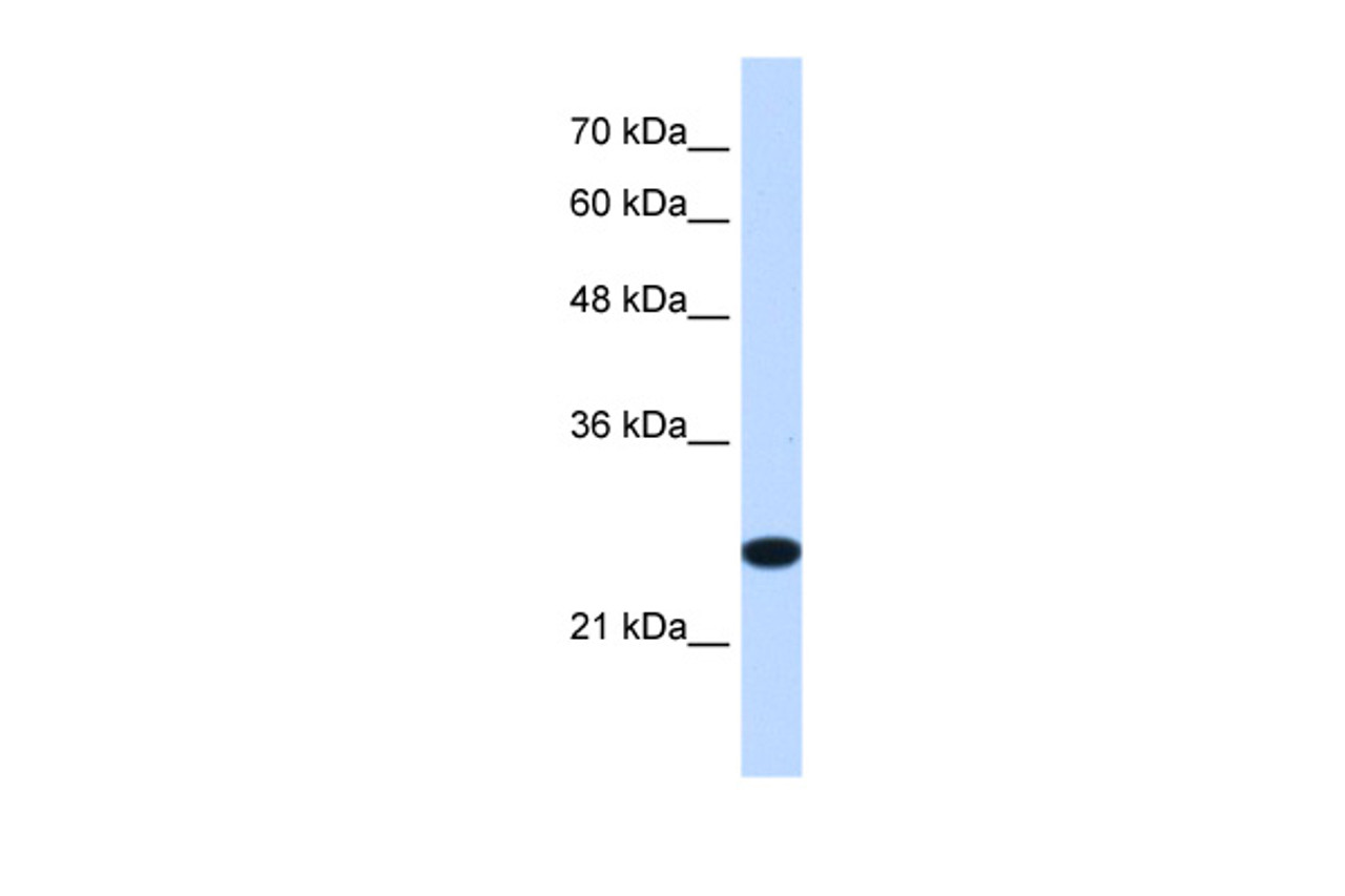 Antibody used in WB on Human Jurkat 1.25 ug/ml.