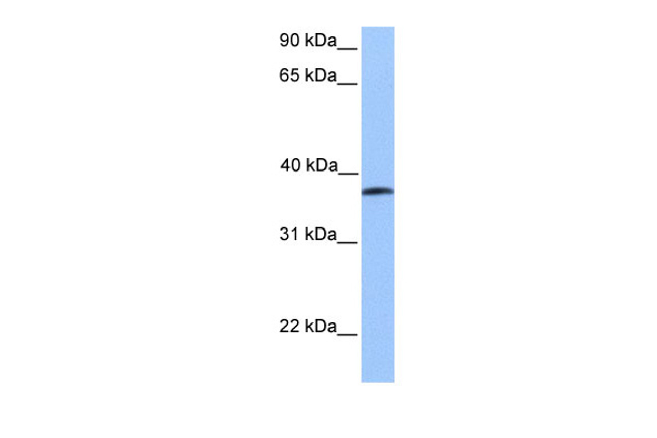 Antibody used in WB on Human Jurkat 0.2-1 ug/ml.