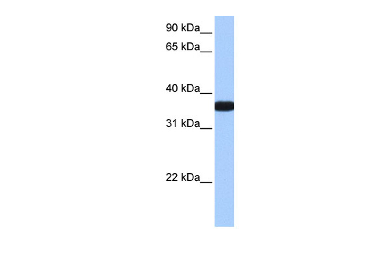 Antibody used in WB on Human Lung at 0.2-1 ug/ml.