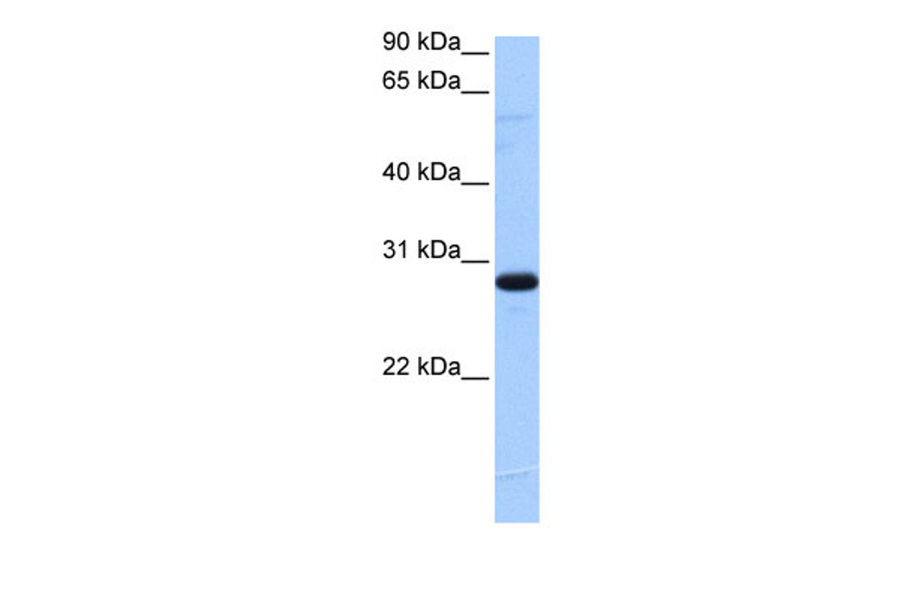 Antibody used in WB on Human Heart at 0.2-1 ug/ml.
