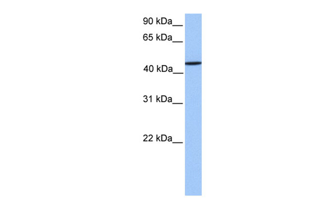 Antibody used in WB on Human Liver at 0.2-1 ug/ml.