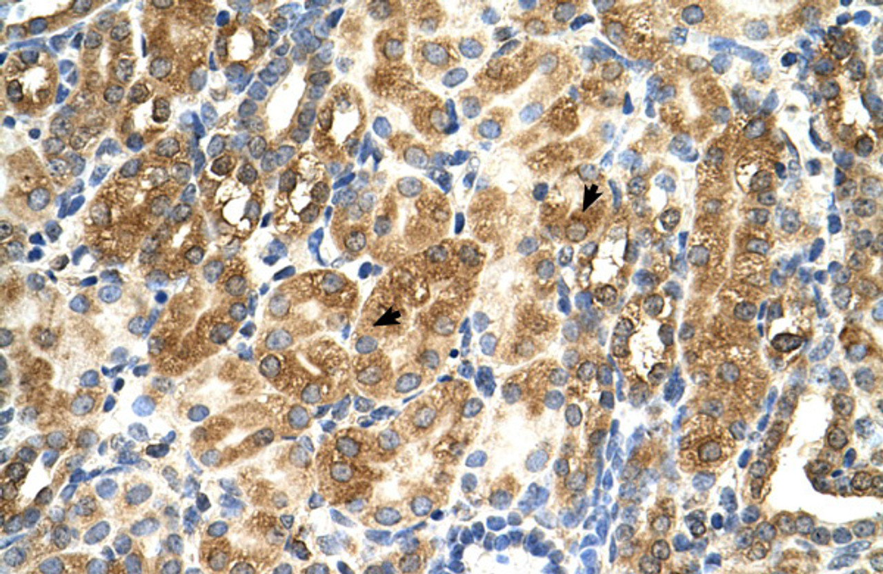 Antibody used in IHC on Human kidney.