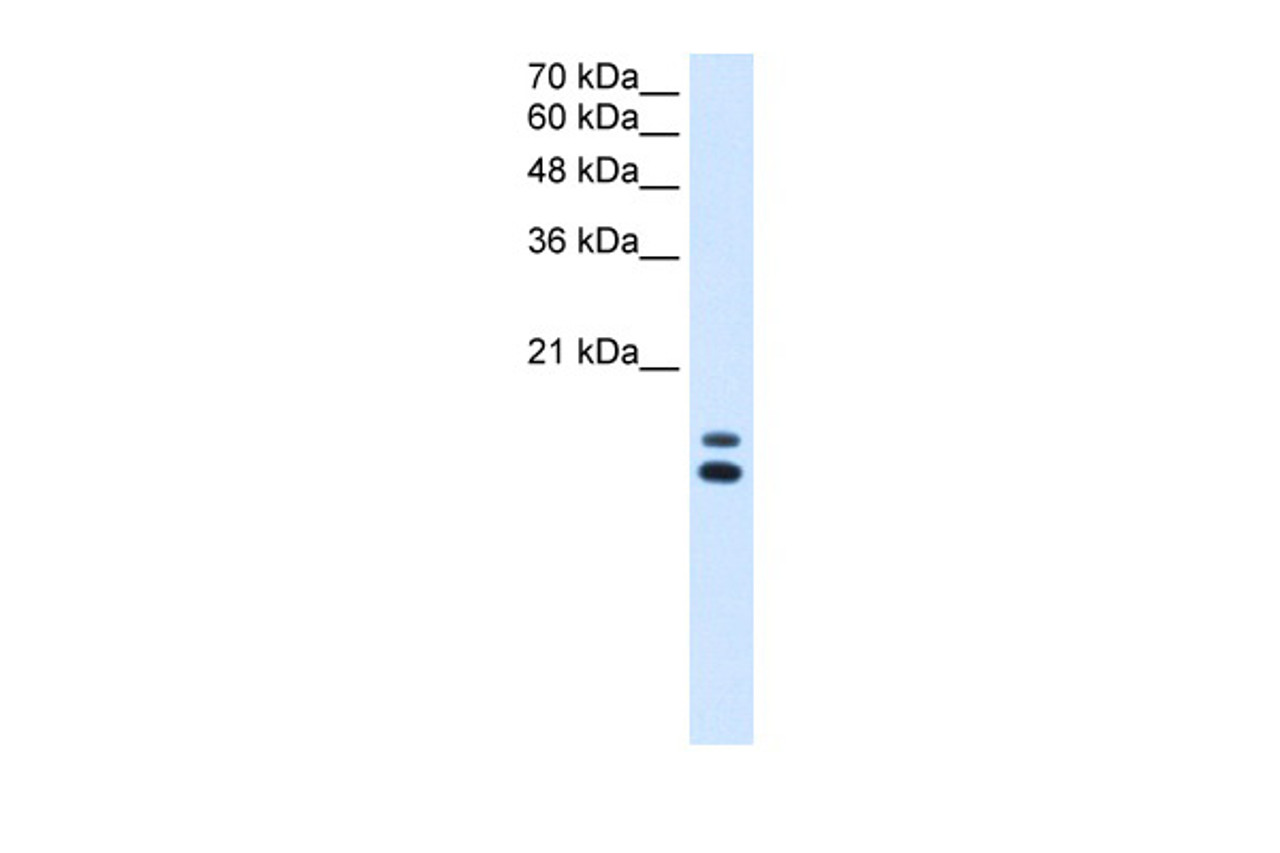 Antibody used in WB on Human HepG2 at 2.5 ug/ml.