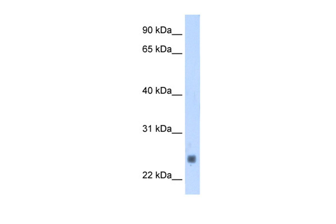 Antibody used in WB on Human Muscle at 1.25 ug/ml.