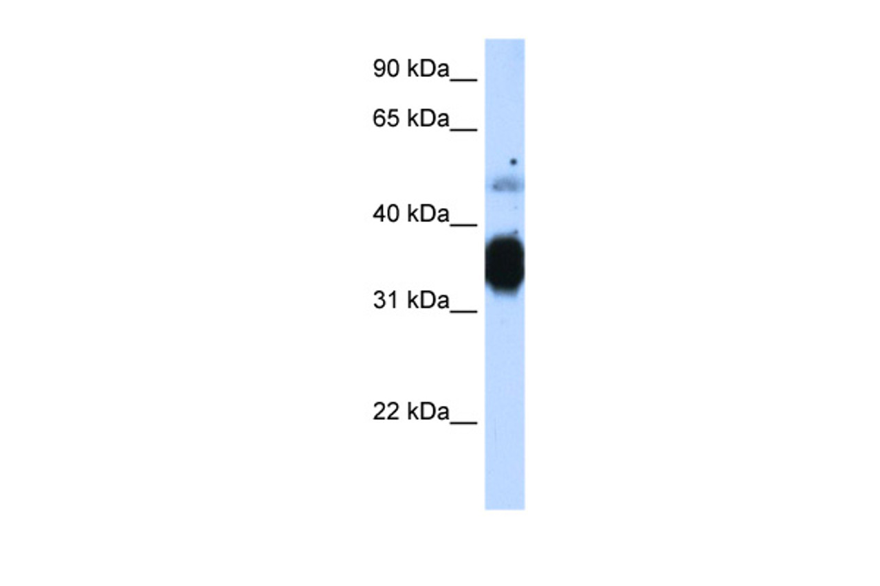 Antibody used in WB on Human Muscle at 1.25 ug/ml.