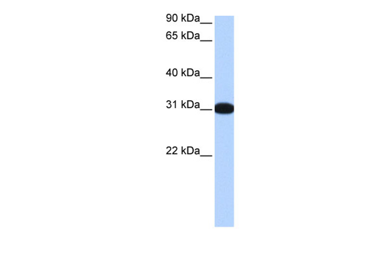 Antibody used in WB on Human Brain at 0.2-1 ug/ml.