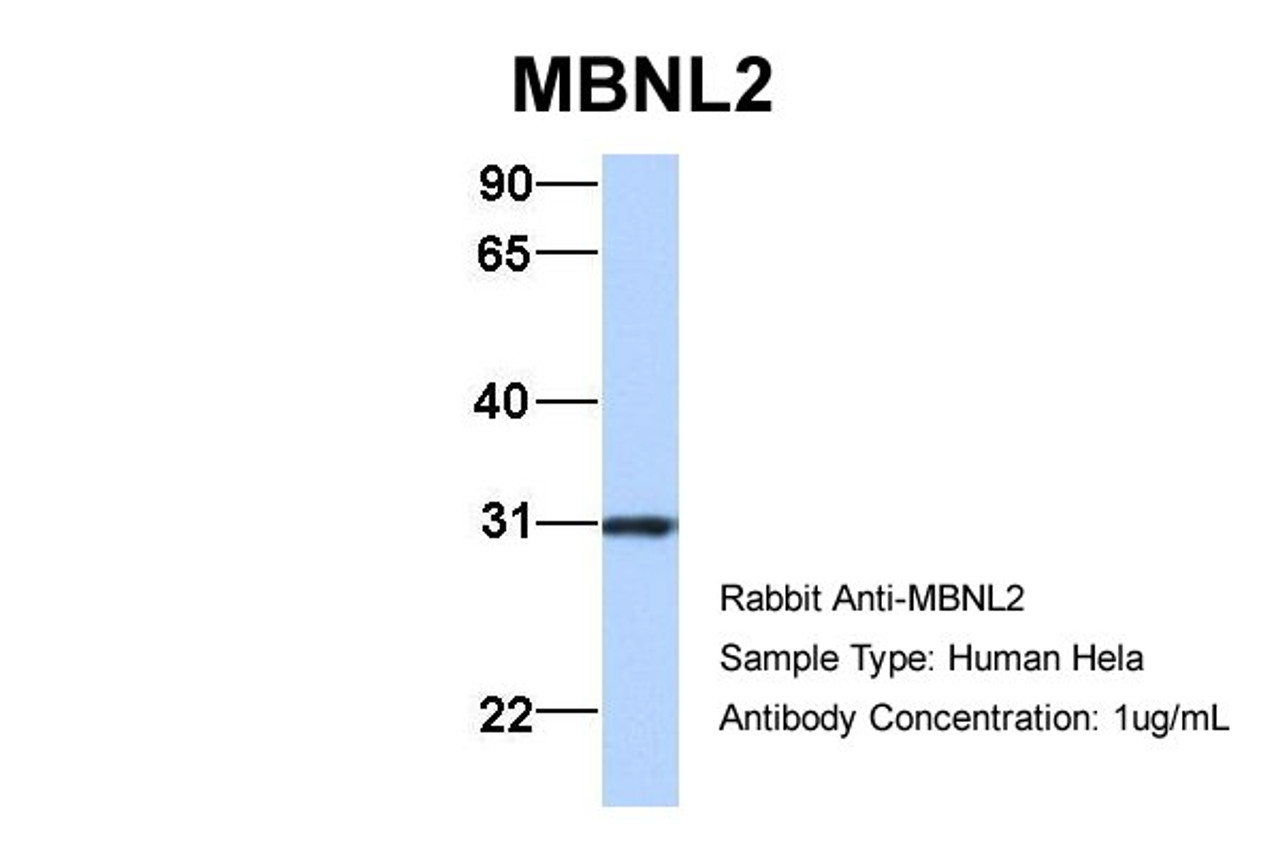 Antibody used in WB on Human Hela at 1 ug/ml.