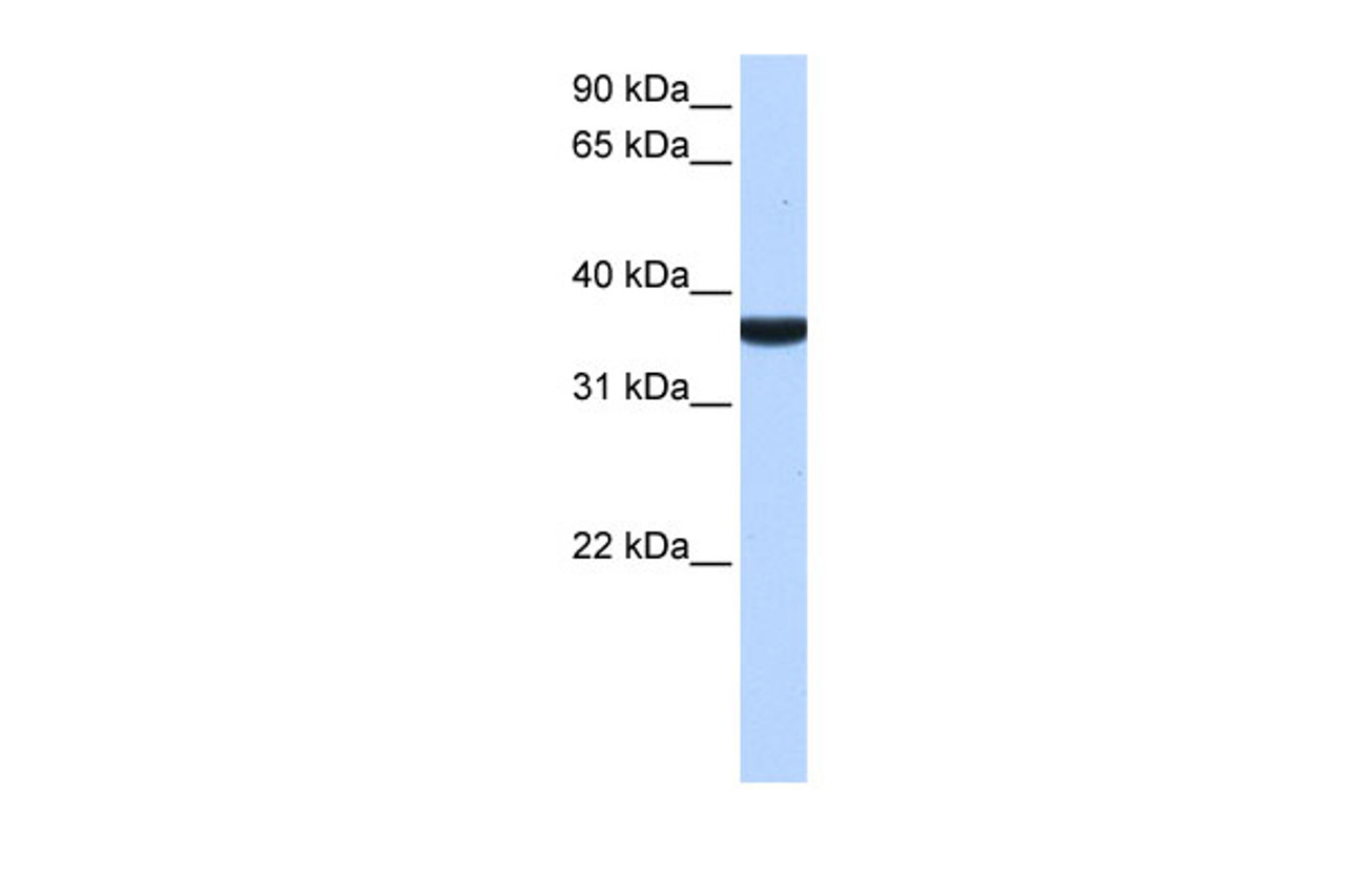 Antibody used in WB on Human Liver at 0.2-1 ug/ml.