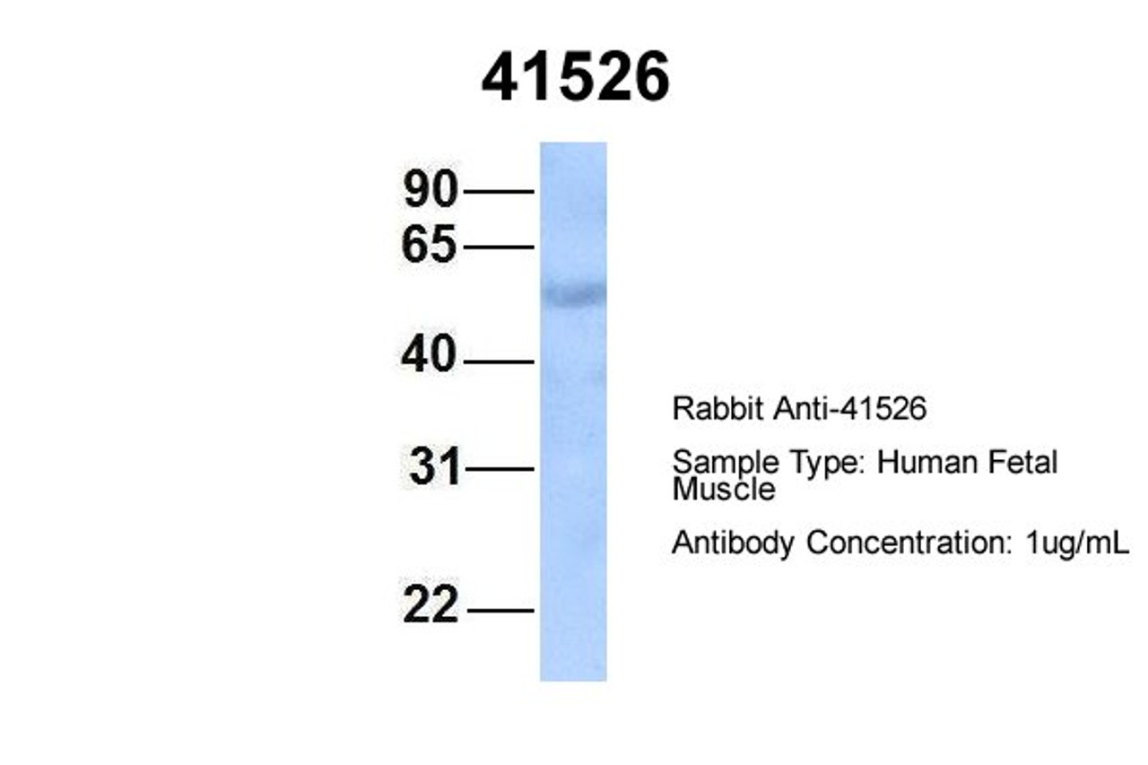 Antibody used in WB on Hum. Fetal Muscle at 1 ug/ml.