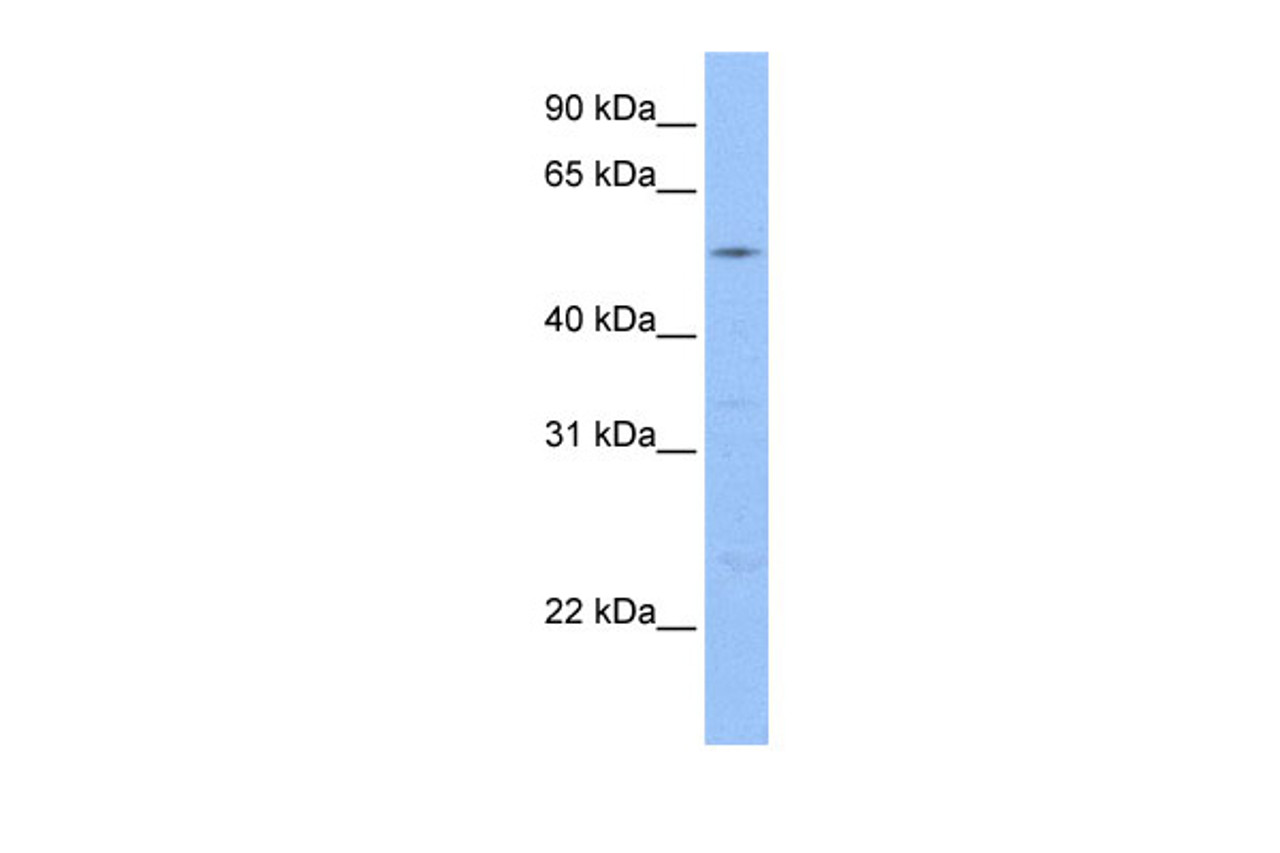 Antibody used in WB on Human 721_B cells at 0.2-1 ug/ml.