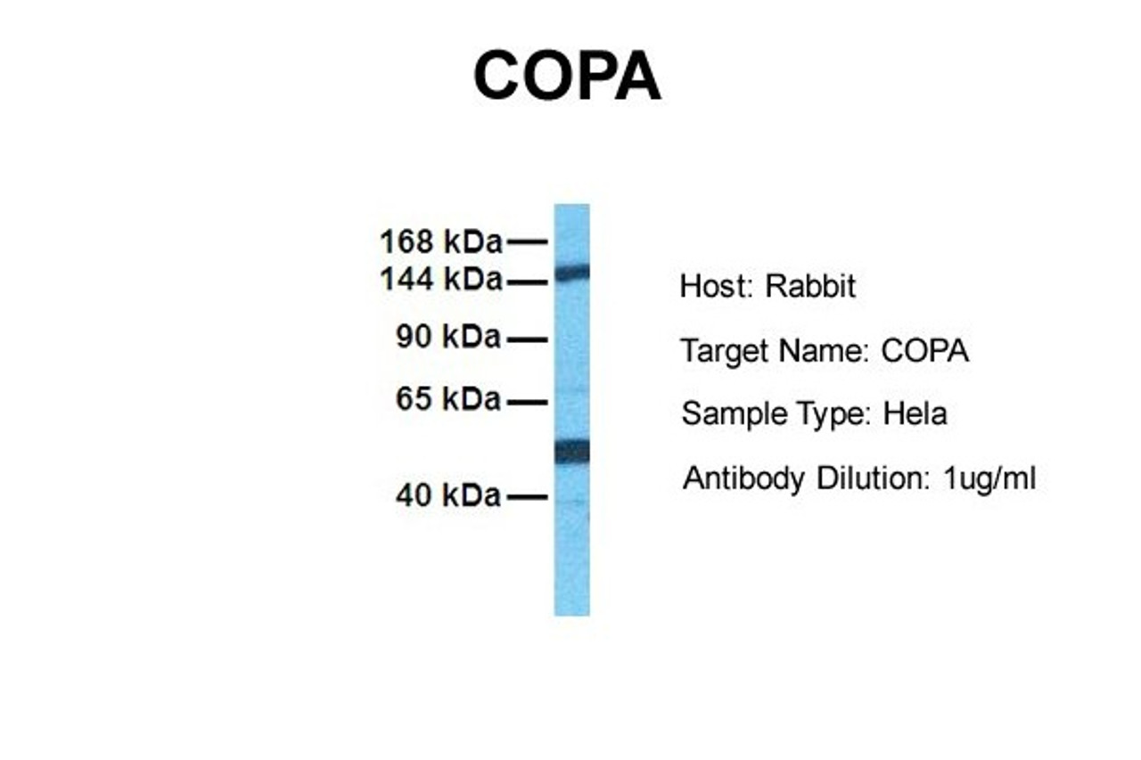 Antibody used in WB on Human HeLa cells at 1 ug/ml.