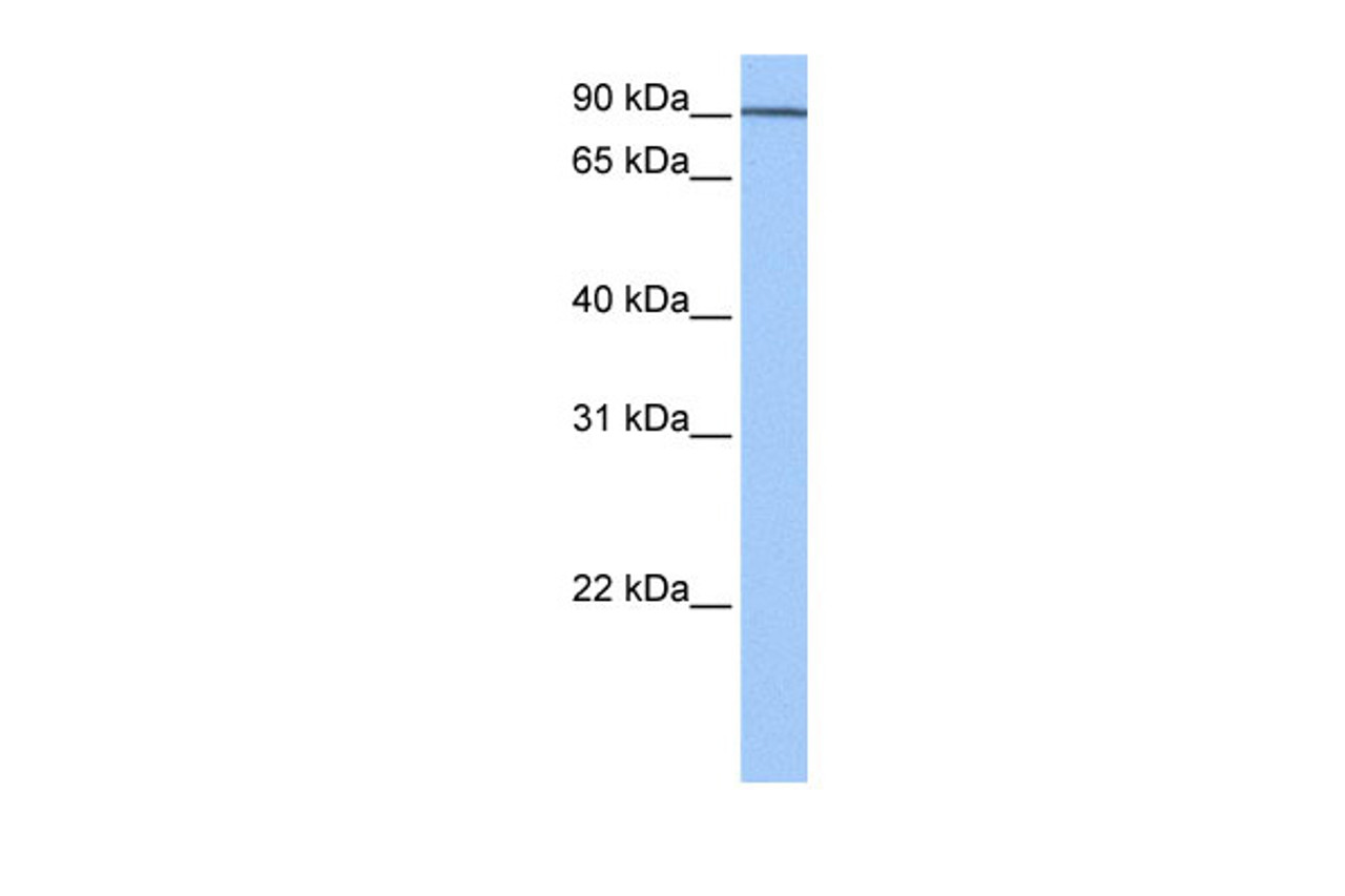 Antibody used in WB on Human Brain at 0.2-1 ug/ml.