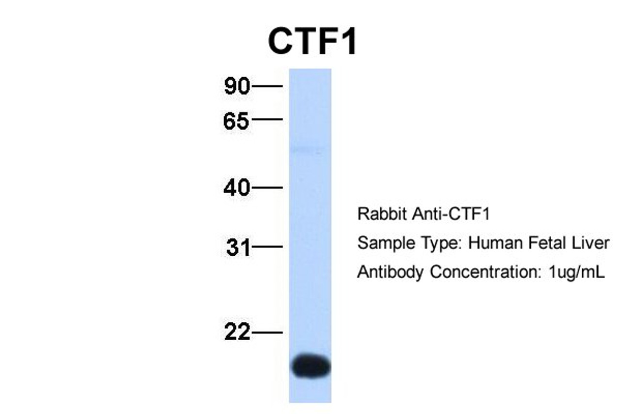 Antibody used in WB on Hum. Fetal Liver at 1 ug/ml.