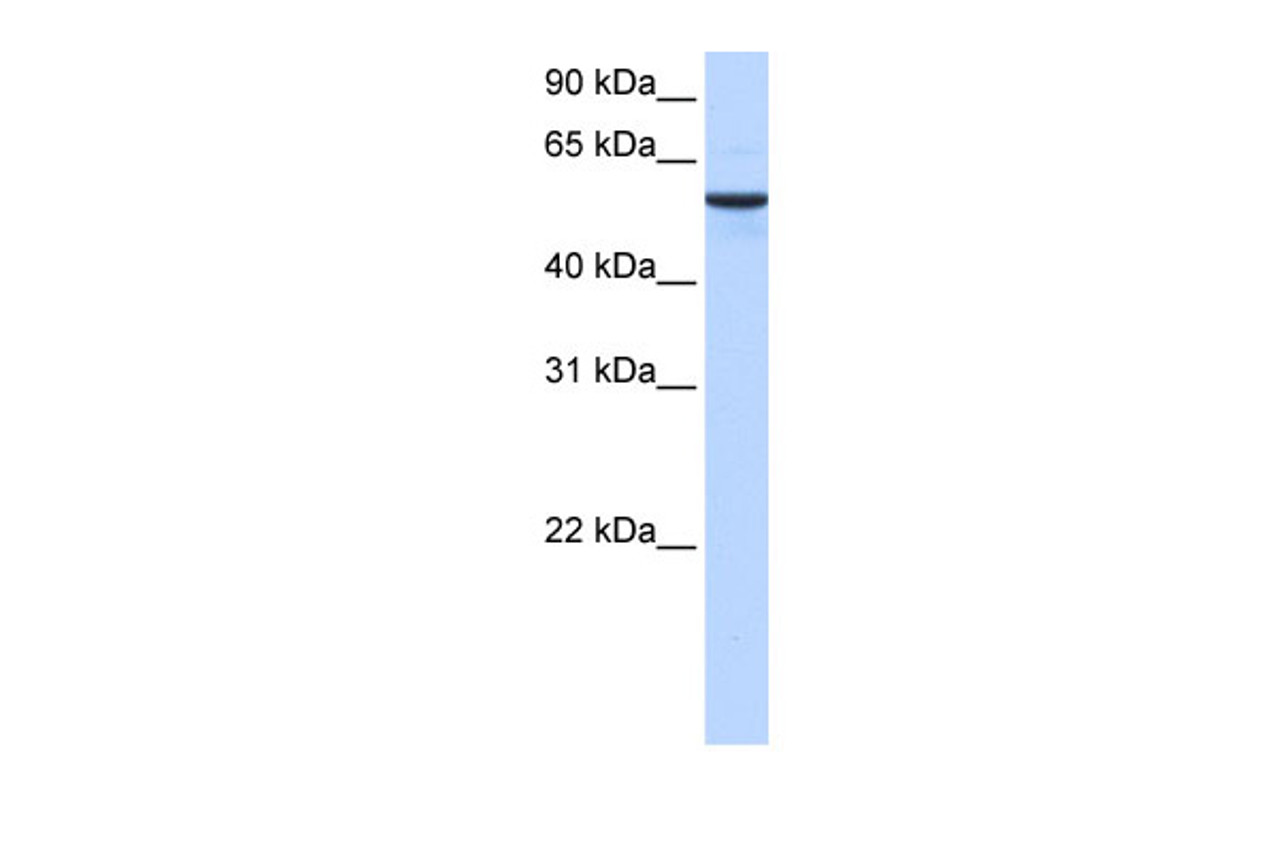 Antibody used in WB on Human Muscle at 0.2-1 ug/ml.