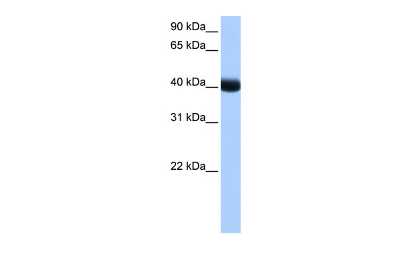 Antibody used in WB on Human Liver at 0.2-1 ug/ml.