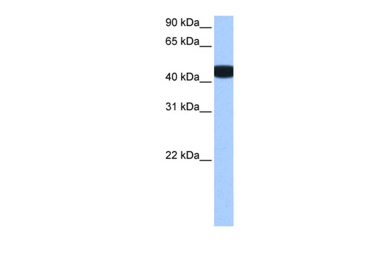 Antibody used in WB on Human Brain at 0.2-1 ug/ml.