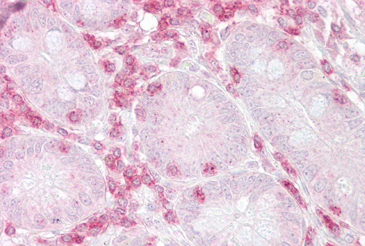 Antibody used in IHC on Human Small intestine.