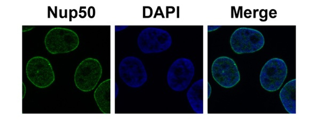 Antibody used in IF on Human HeLa.