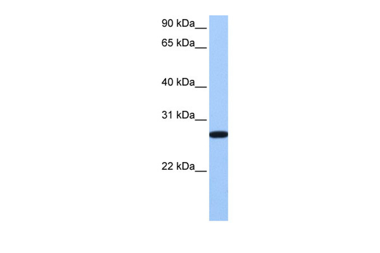 Antibody used in WB on Human HeLa at 0.2-1 ug/ml.