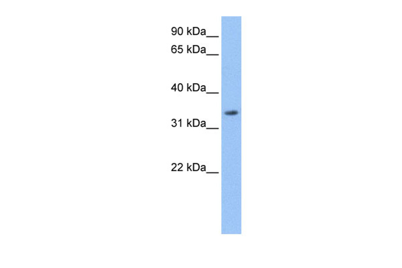 Antibody used in WB on Human HepG2 at 0.2-1 ug/ml.