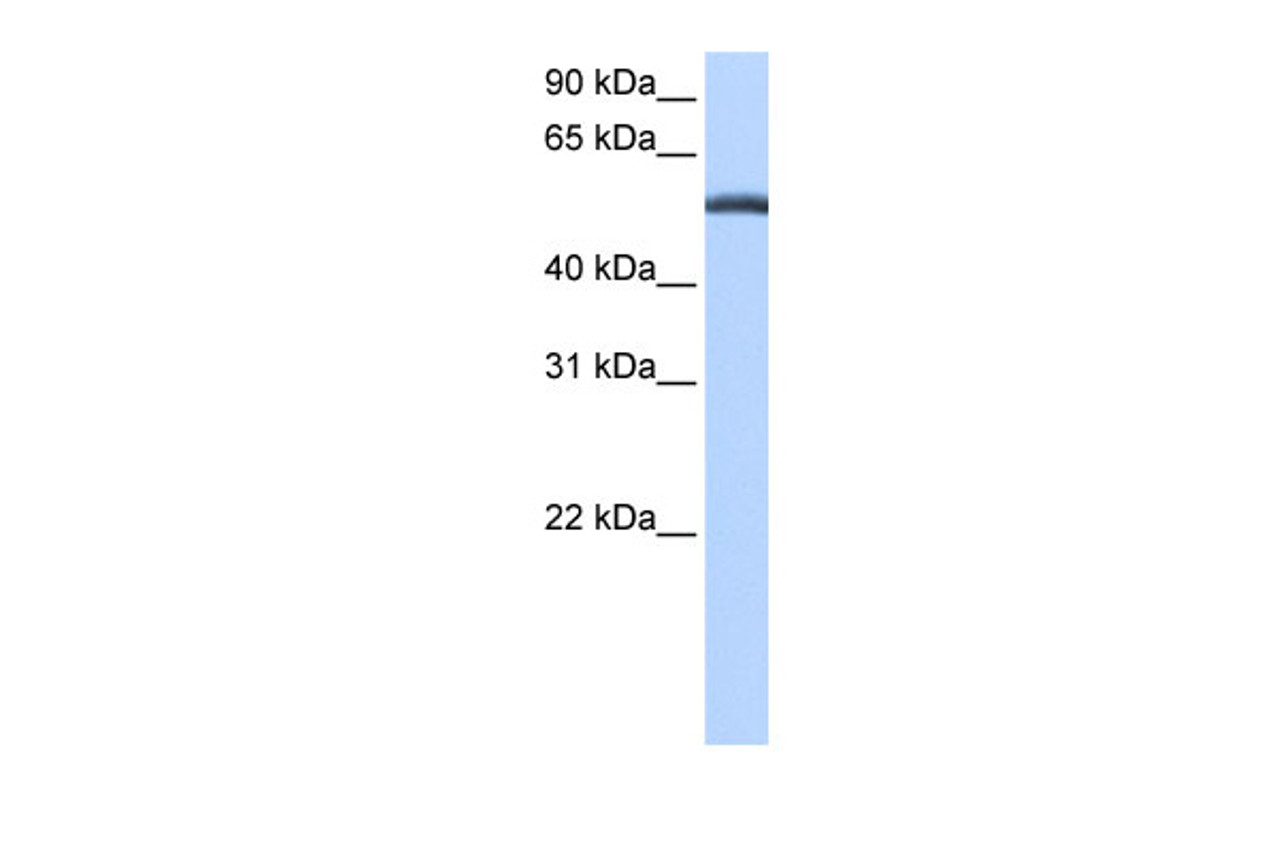 Antibody used in WB on Human Liver at 0.2-1 ug/ml.