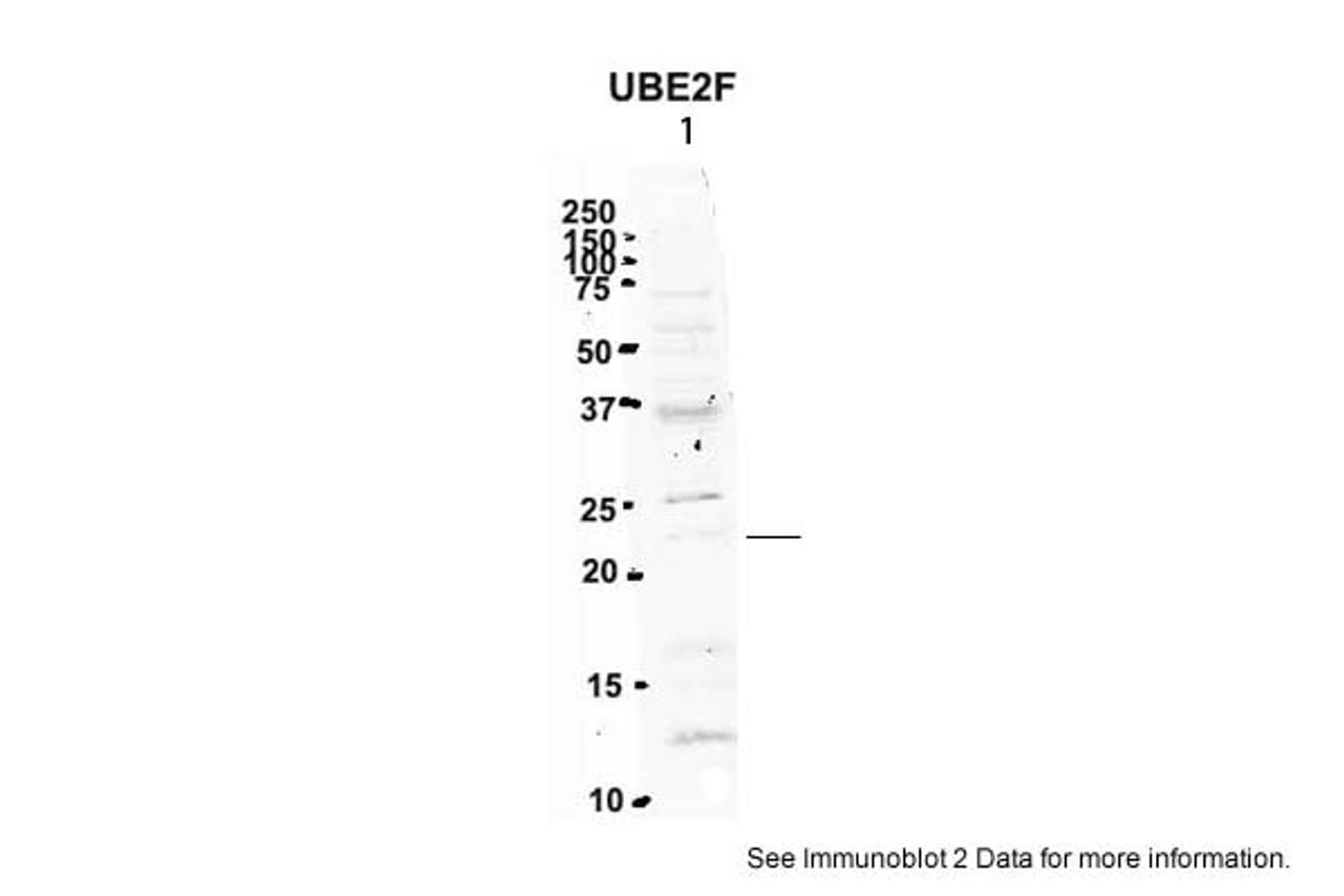Antibody used in WB on Mouse Brain at 2 ug/ml.