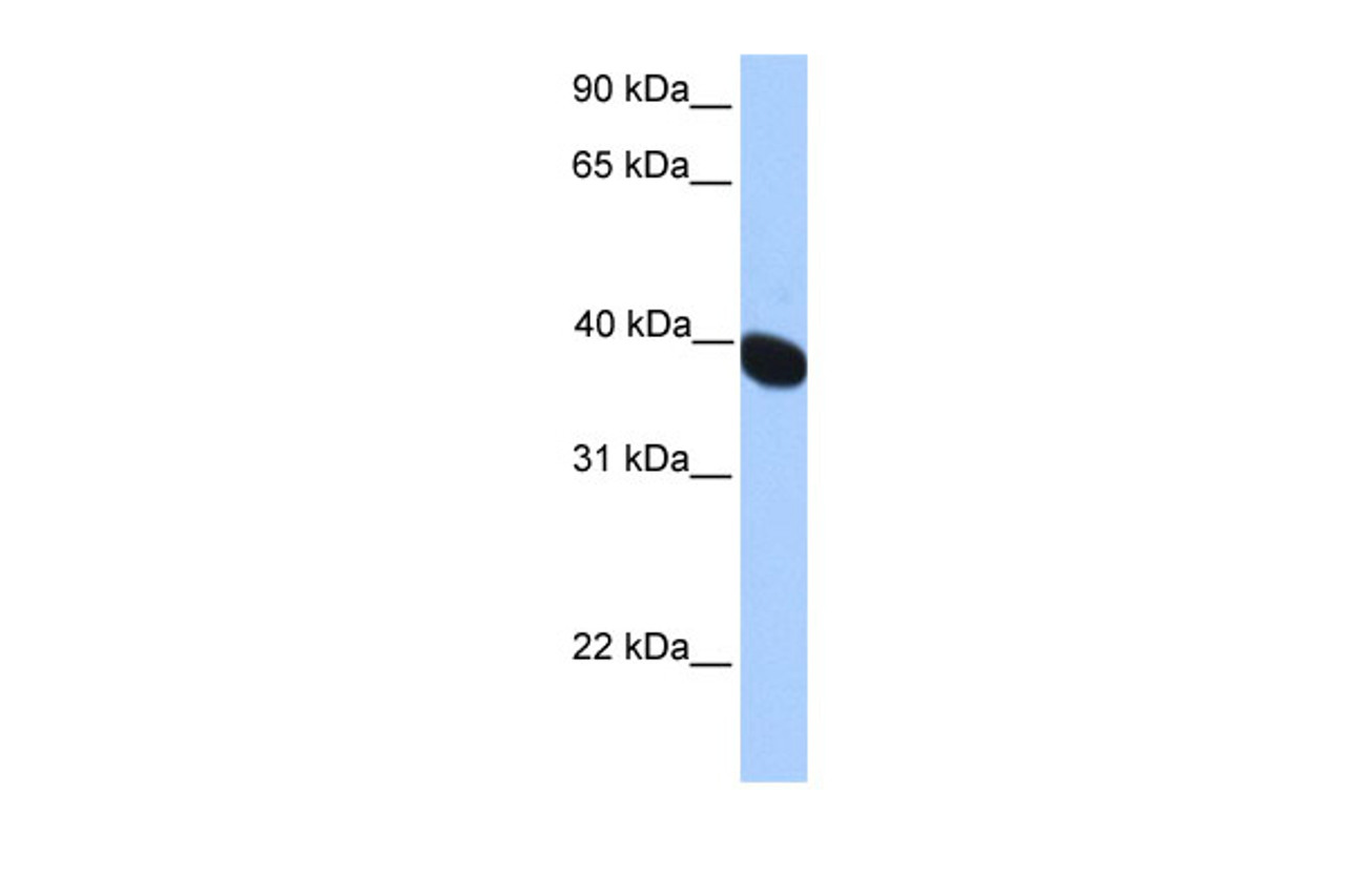 Antibody used in WB on Human Muscle at 0.2-1 ug/ml.