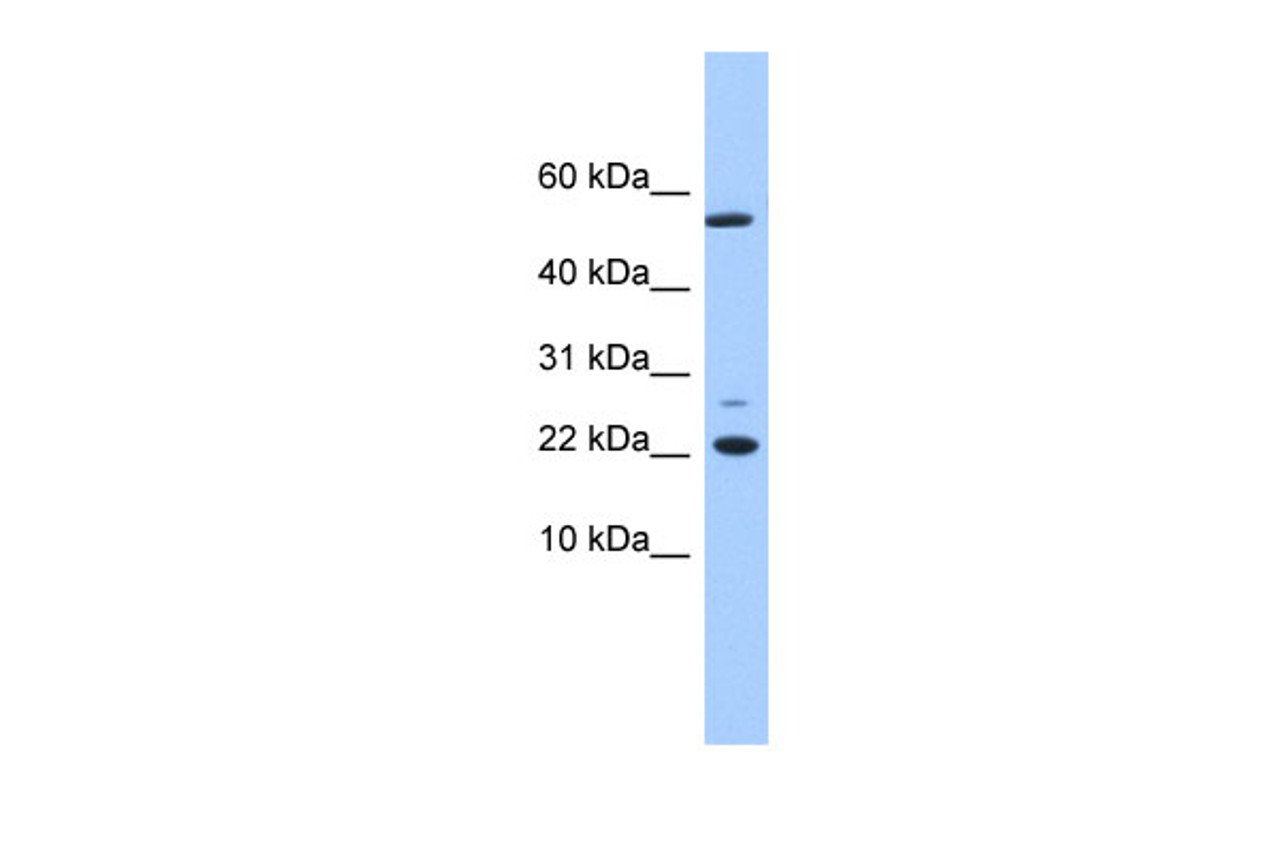 Antibody used in WB on Human Liver at 0.2-1 ug/ml.