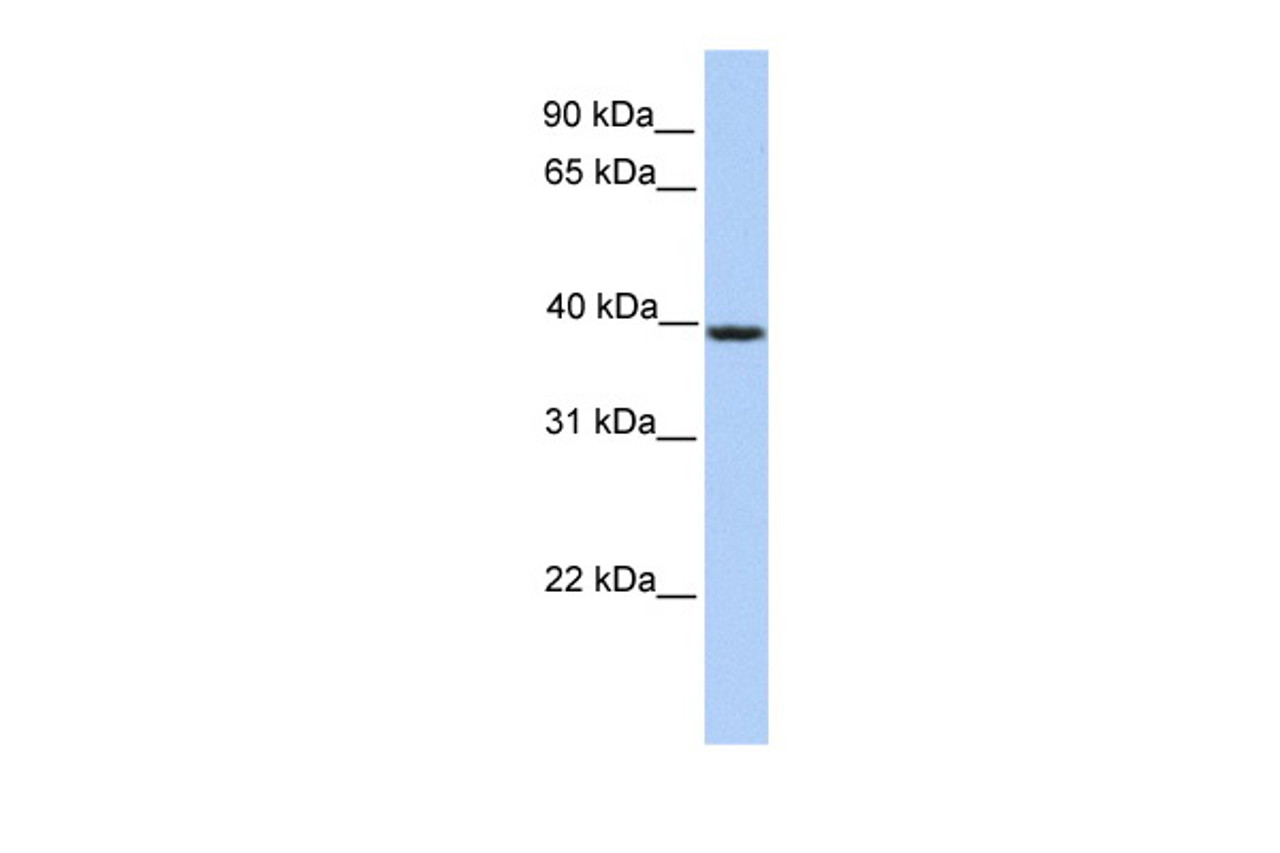 Antibody used in WB on Human Jurkat 0.2-1 ug/ml.