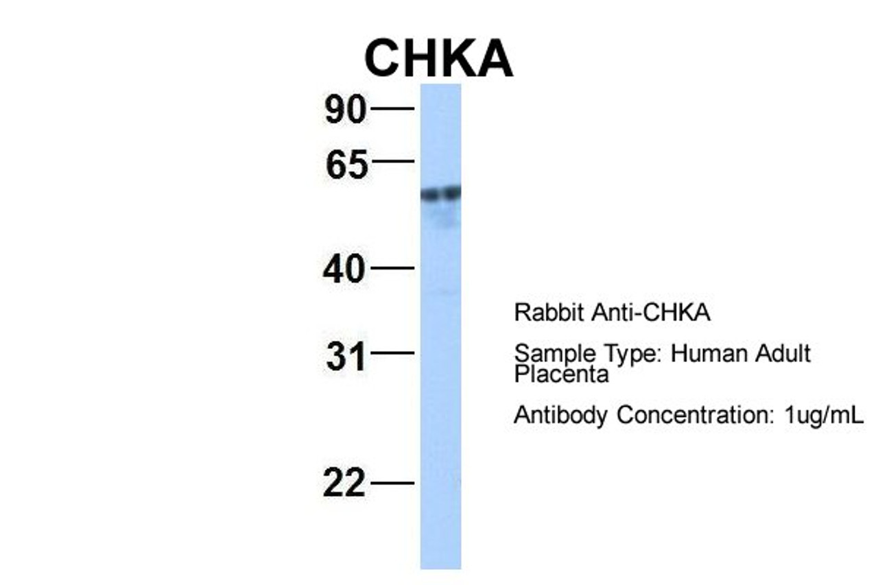 Antibody used in WB on Hum. Adult Placenta at 1 ug/ml.