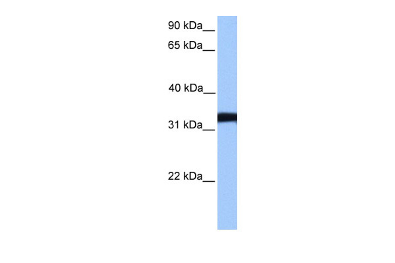 Antibody used in WB on Human NTERA2 at 0.2-1 ug/ml.