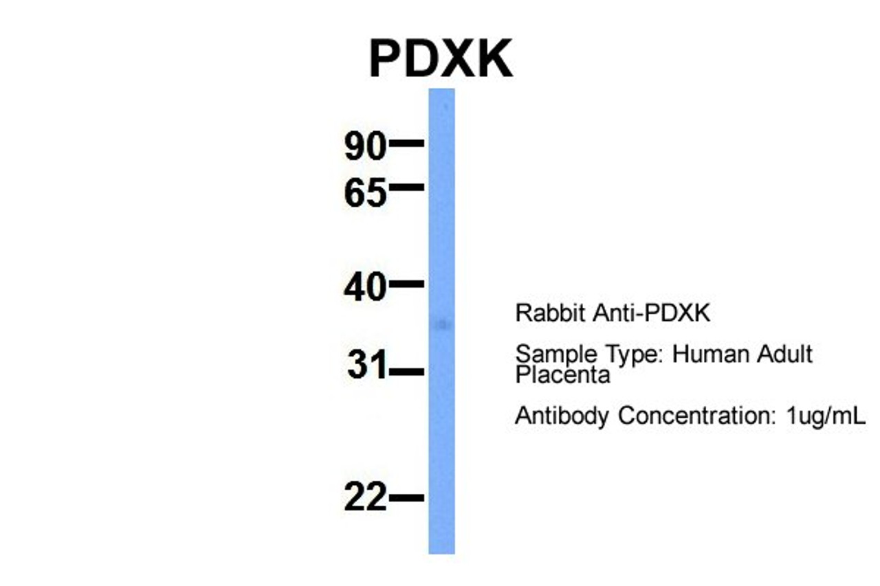 Antibody used in WB on Hum. Adult Placenta at 1 ug/ml.