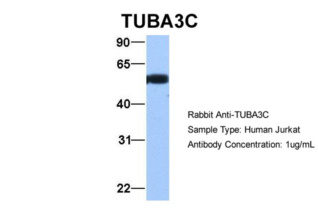 Antibody used in WB on Human Jurkat 1 ug/ml.