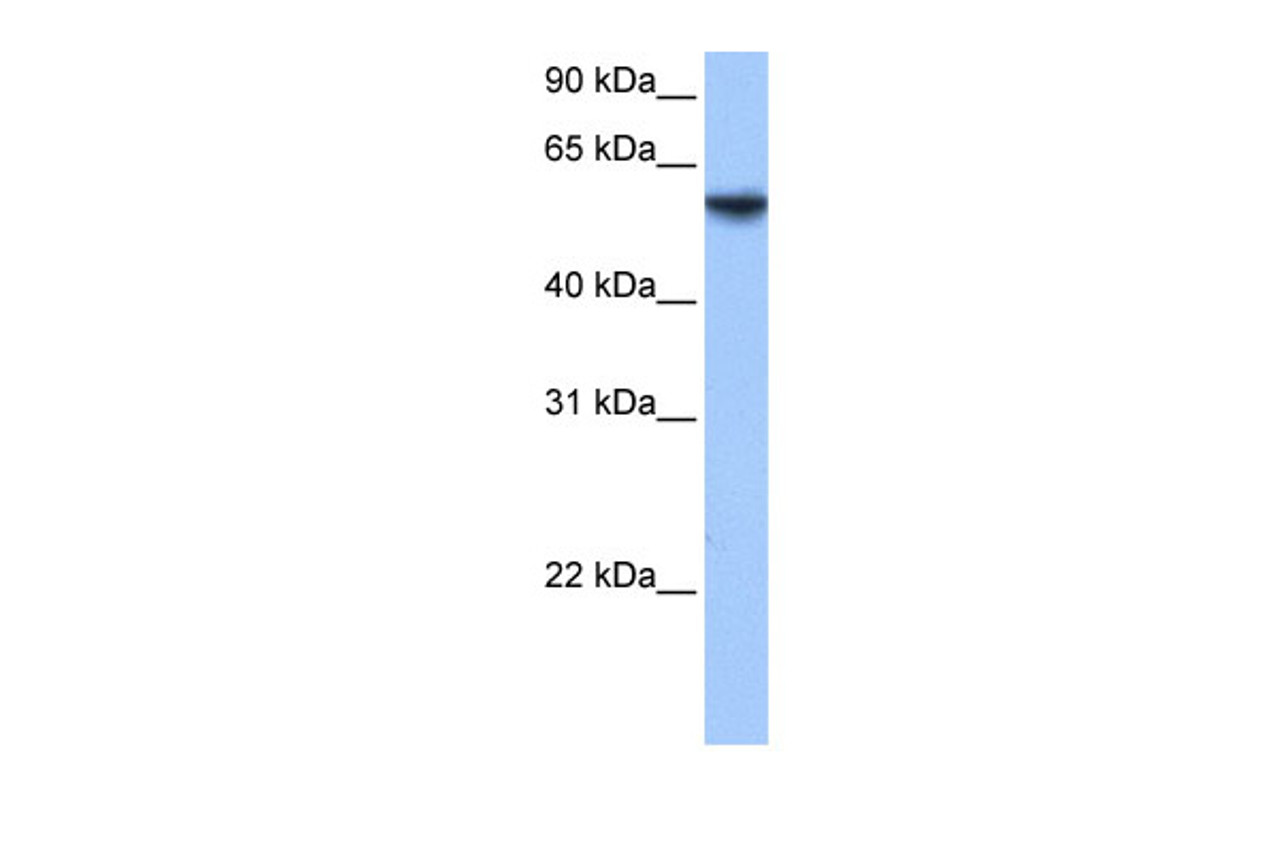 Antibody used in WB on Human Lung at 0.2-1 ug/ml.