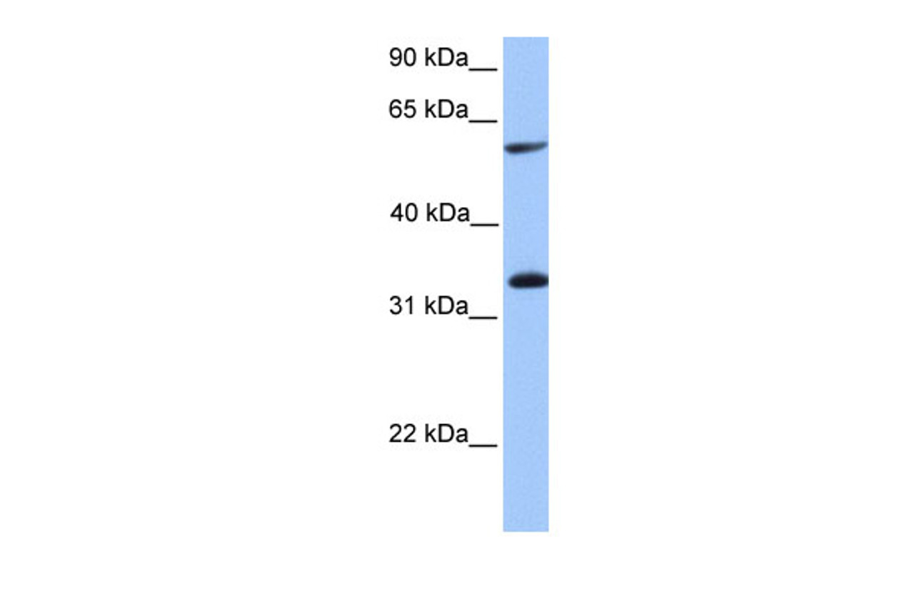 Antibody used in WB on Human Placenta at 0.2-1 ug/ml.