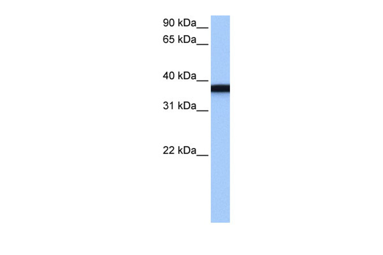 Antibody used in WB on Human NTERA2 at 0.2-1 ug/ml.