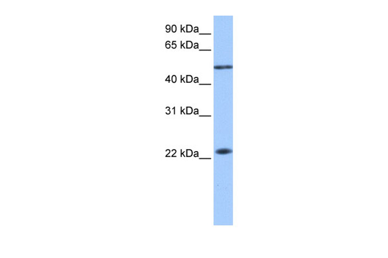 Antibody used in WB on Human Liver at 0.2-1 ug/ml.