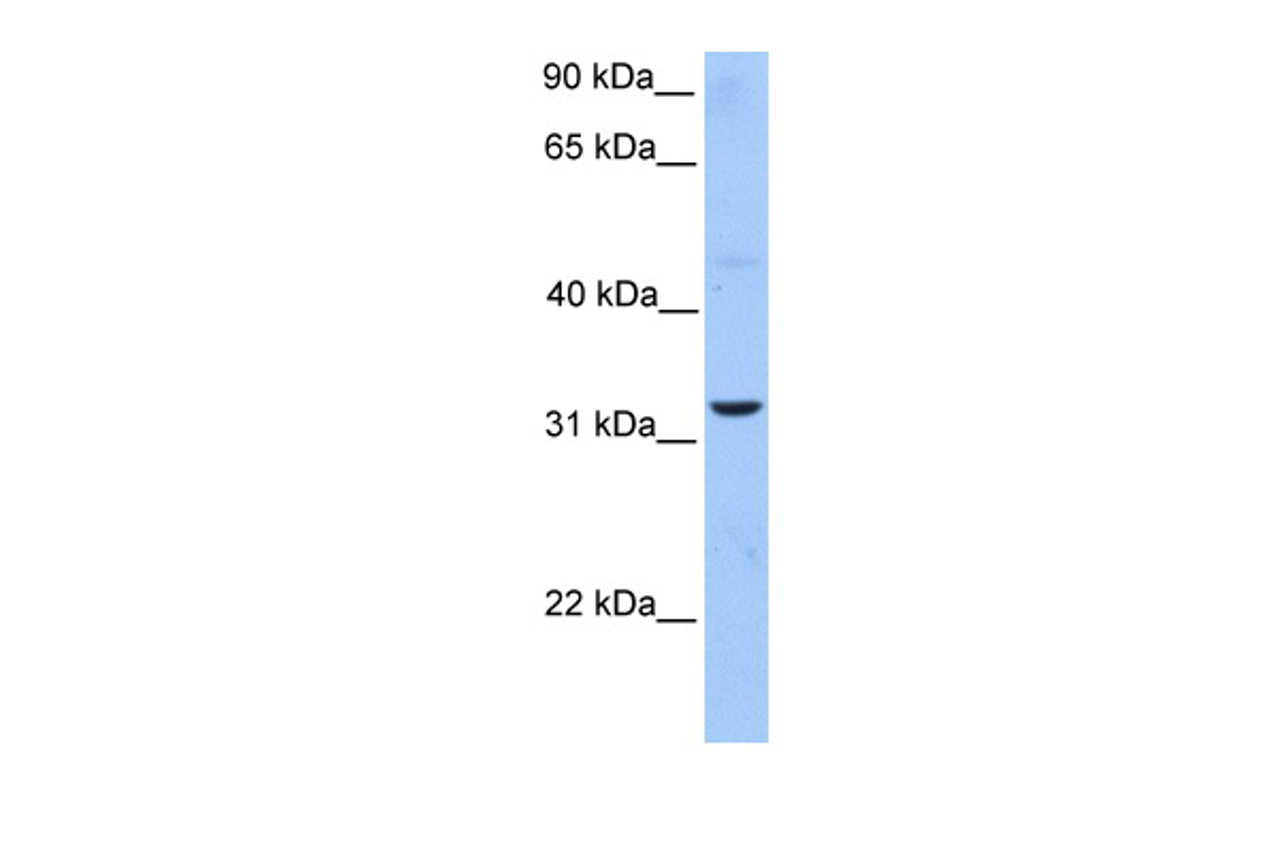 Antibody used in WB on Human HepG2 at 1 ug/ml.