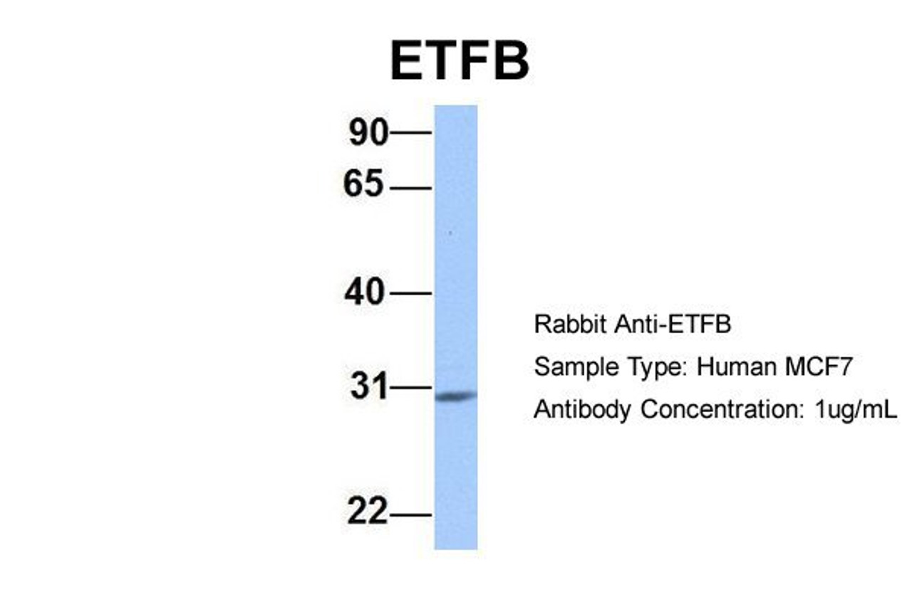 Antibody used in WB on Human MCF7 at 1 ug/ml.