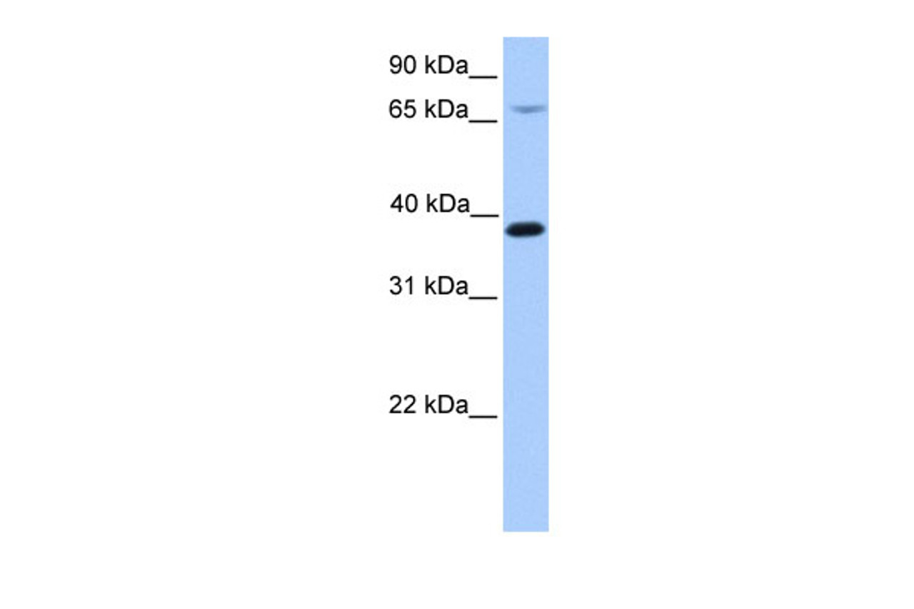 Antibody used in WB on Human 721_B at 0.2-1 ug/ml.