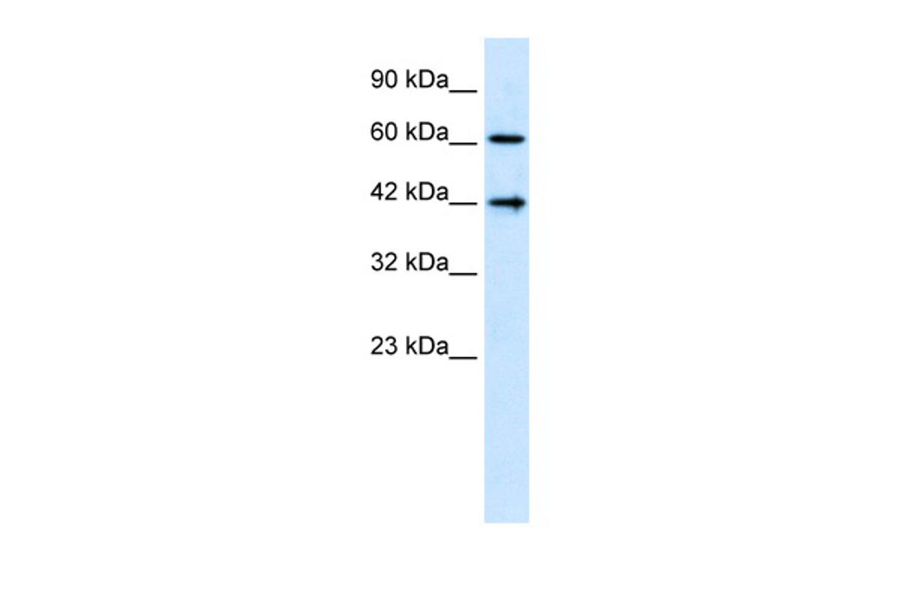 Antibody used in WB on Human HepG2 cells at 1.25 ug/ml.