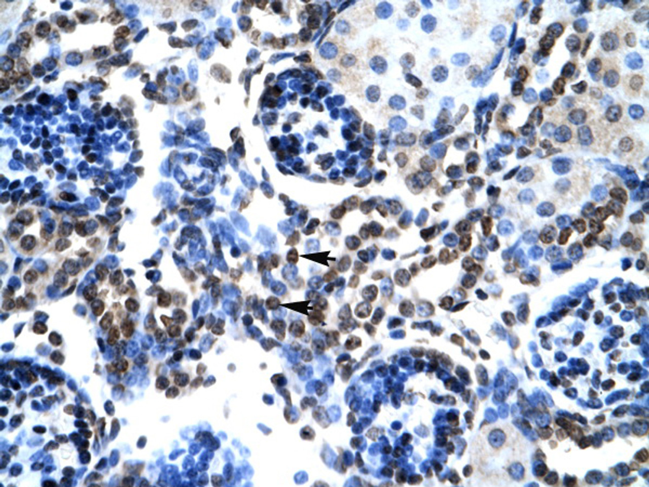 Antibody used in IHC on Human kidney.