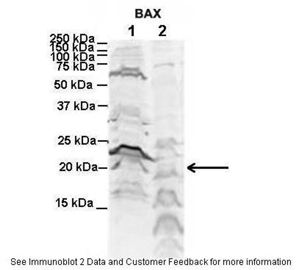 Antibody used in WB on Human NT-2 and Mouse WT brain at 2 ug/ml (Lane 1. Human NT-2 cells (60ug) lysate 2. Mouse WT brain extract (80ug) ) .