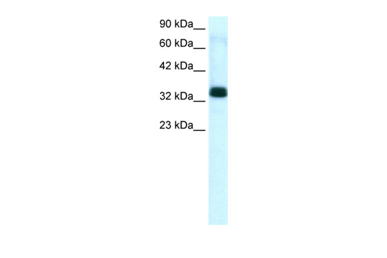 Antibody used in WB on Human Jurkat cells at 1.25 ug/ml.